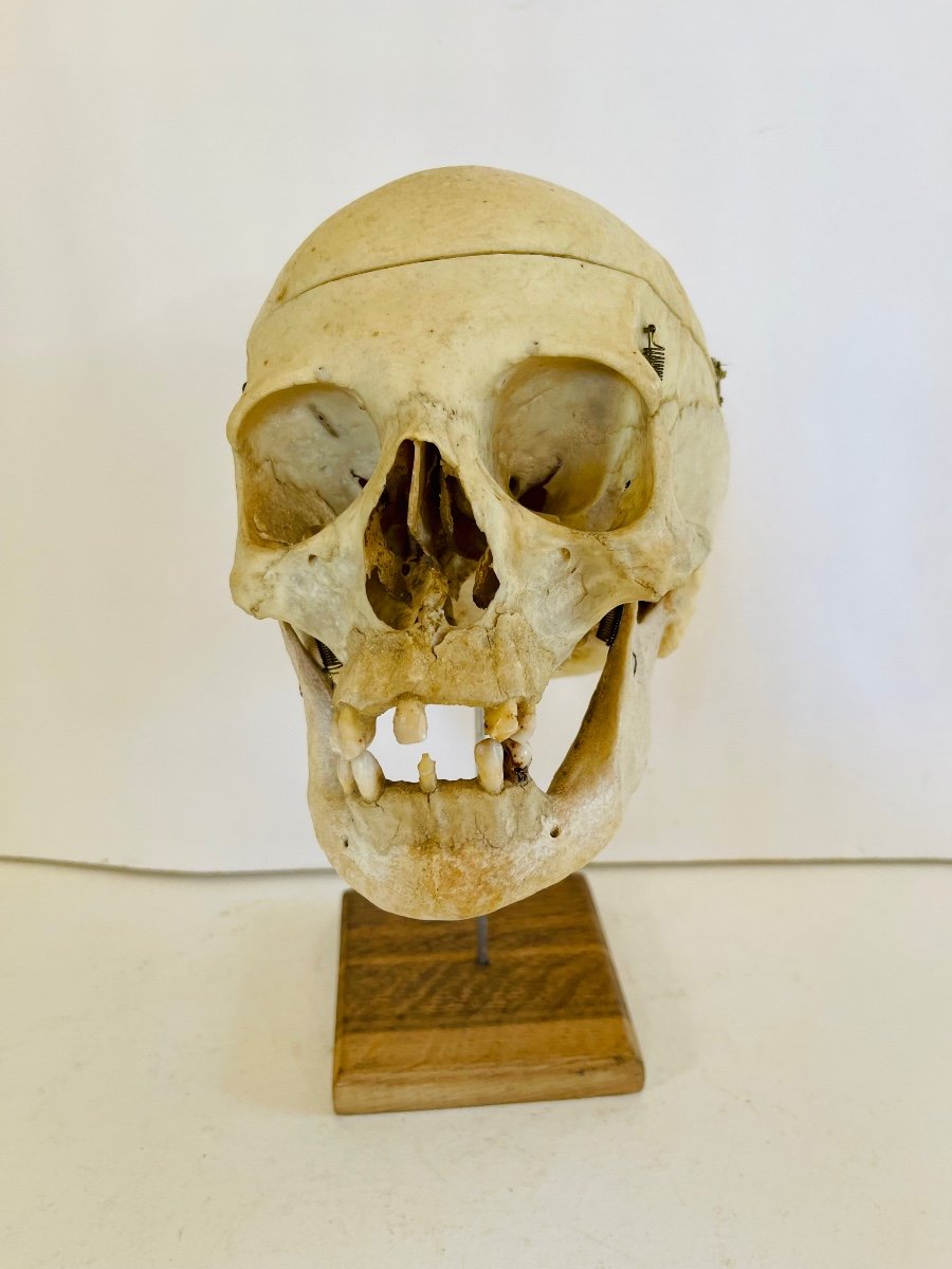 Educational Skull 